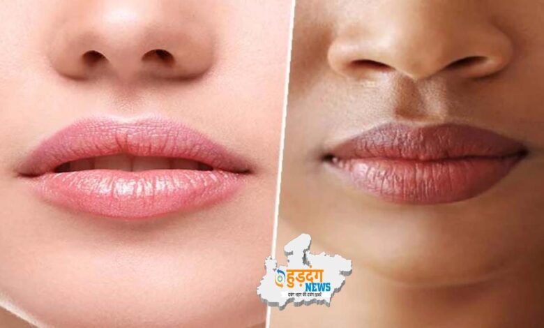 Dark Lips Healing Tips : डार्क लिप्स को ठीक करने के लिए जानें ये टिप्स