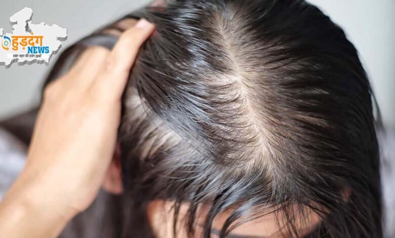 Remedies For Hair Thinning : पतले बालों से परेशान हैं तो अपनाएं ये टिप्स