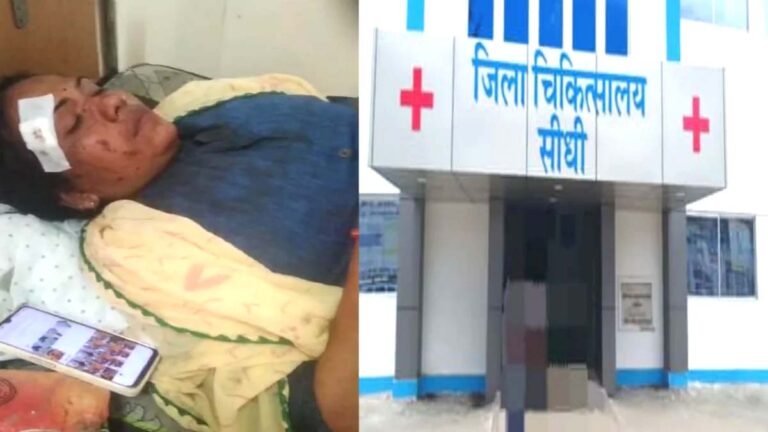 MP NEWS: आंगनवाड़ी कार्यकर्ताओं के साथ रिश्तेदारों ने की मारपीट