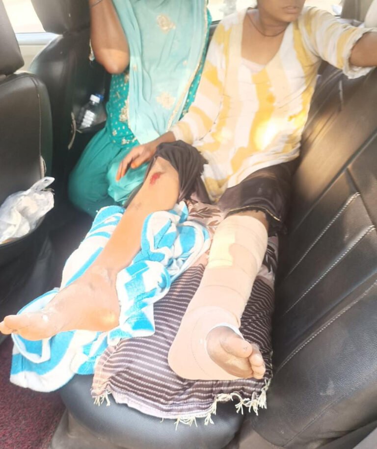 Singrauli: ब्लास्टिंग से मकान का हिस्सा गिरा, एक किशोरी दबकर हुई घायल