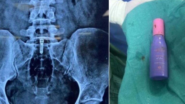 महिला ने प्राइवेट पार्ट में घुसाई मॉइस्चराइजर की बोतल