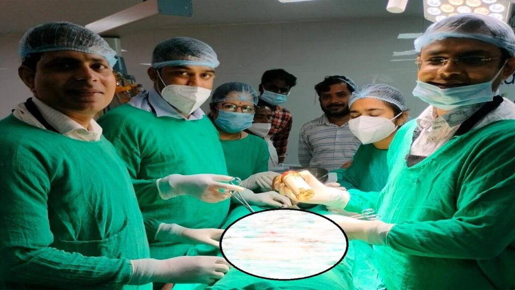 MP : मलद्वार से युवक के पेट में पहुंची बॉटल, डॉक्टरों ने ऑपरेशन से निकाला 1 MP : मलद्वार से युवक के पेट में पहुंची बॉटल, डॉक्टरों ने ऑपरेशन से निकाला