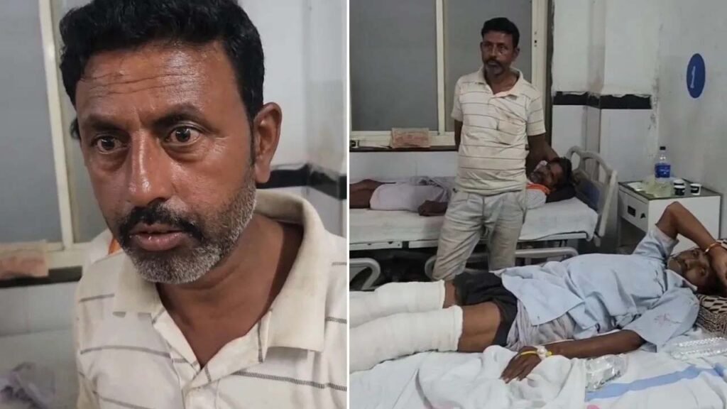 राज्यमंत्री के काफिले की टक्कर, काटना पड़ा पैर 2 राज्यमंत्री के काफिले की टक्कर, काटना पड़ा पैर