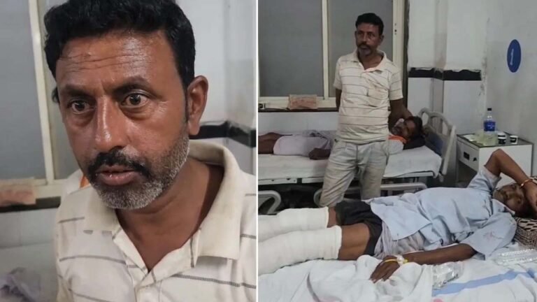 राज्यमंत्री के काफिले की टक्कर, काटना पड़ा पैर