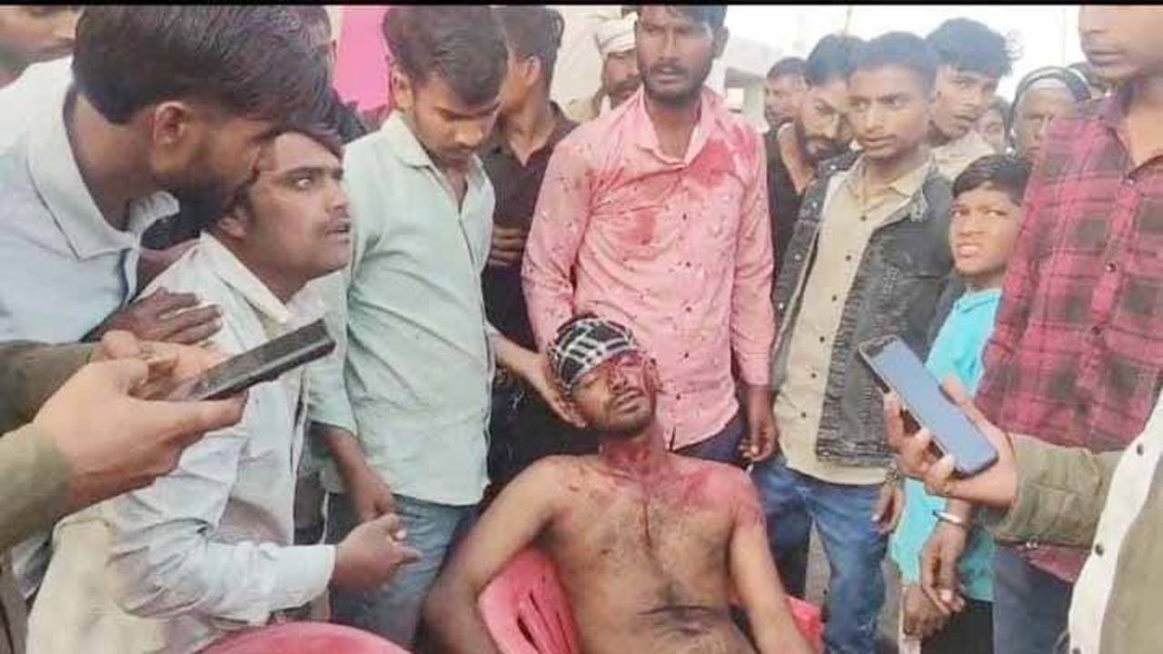 Singrauli: झूला संचालक की बेदम पिटाई कर किया लहुलुहान